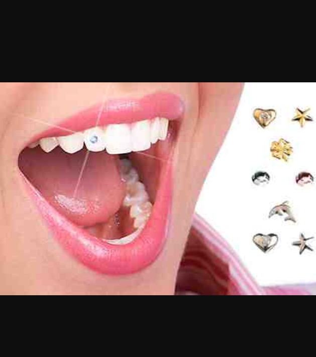 Twinkle Tooth Jewelery, the lastest craze